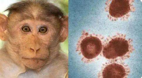 亚洲多国出现猴痘病例