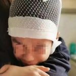 河南9岁男孩被老师揪发致使头皮头骨分离 涉事老师已被刑拘