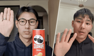 中荷混血男子天生没有拇指，却在网上走红